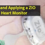 Wearing a Zio IRhythm heart monitor
